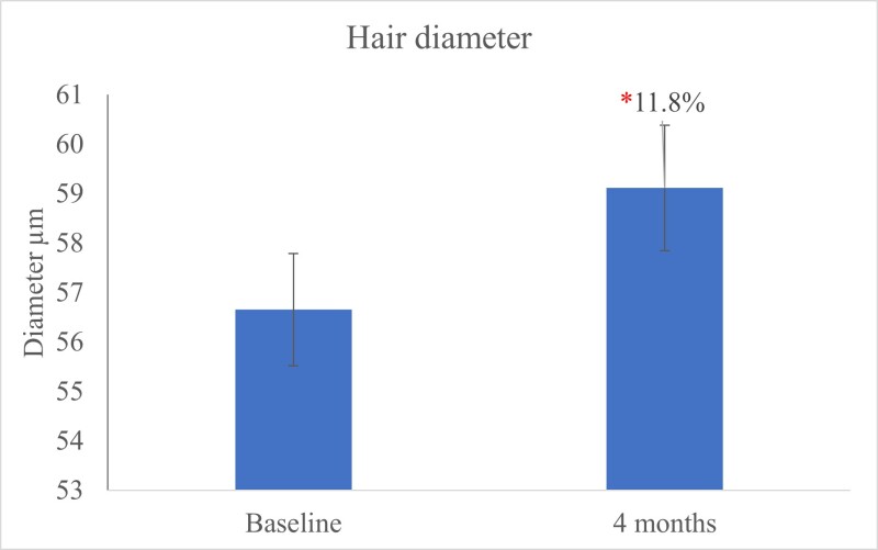 Methylsulfonylmethane and Hair Health Natural Medicine Journal